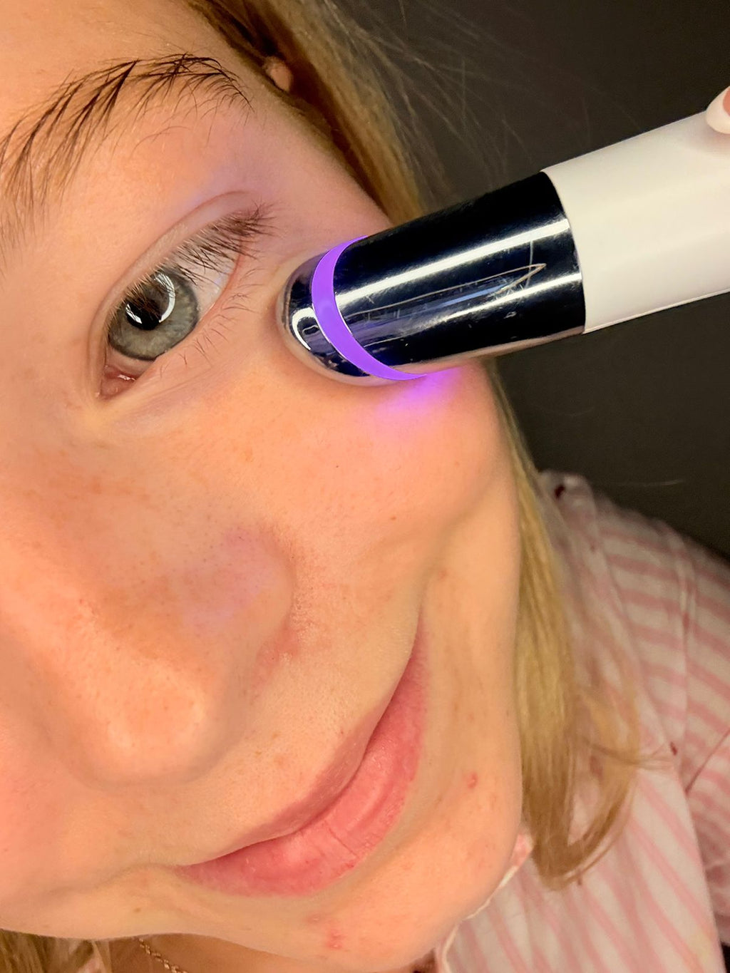 Lumaé EyeSculpt LED Lift & Glow Wand